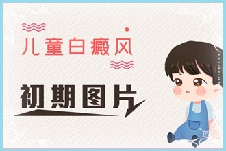 白癩風(fēng)對不同人群的是不一樣的嗎